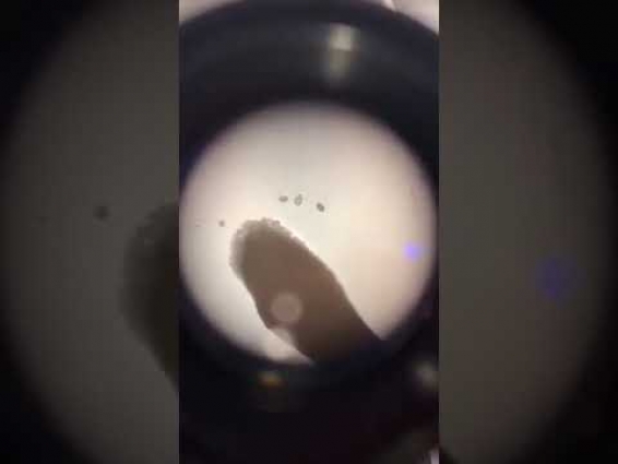 Tapeworm under the microscope – Veterinary Video