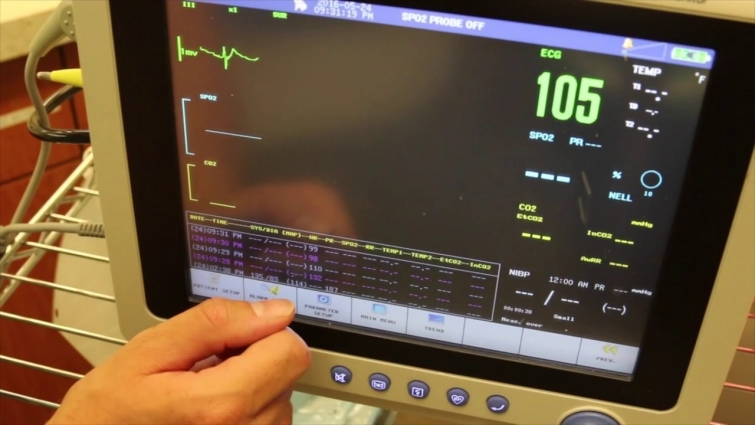 ECG Interpretation Tutorial for Veterinary Technicians